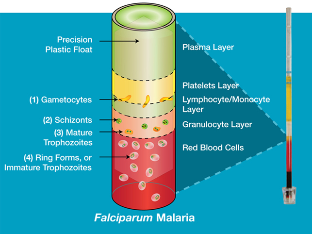 QBC Malaria Tube